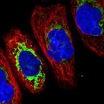 TMCO6 Polyclonal Antibody