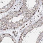 TMCO6 Antibody in Immunohistochemistry (IHC)