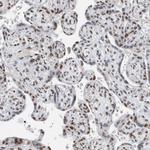 FIP1L1 Antibody in Immunohistochemistry (Paraffin) (IHC (P))