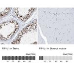 FIP1L1 Antibody in Immunohistochemistry (IHC)