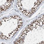 FIP1L1 Antibody in Immunohistochemistry (IHC)