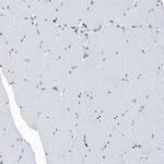 FIP1L1 Antibody in Immunohistochemistry (IHC)