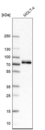 FIP1L1 Antibody in Western Blot (WB)