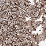 RBM17 Polyclonal Antibody