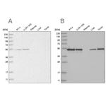 RBM17 Antibody in Western Blot (WB)