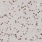 RBM17 Antibody in Immunohistochemistry (Paraffin) (IHC (P))