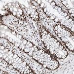 RBM17 Antibody in Immunohistochemistry (Paraffin) (IHC (P))