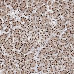 RBM17 Antibody in Immunohistochemistry (Paraffin) (IHC (P))