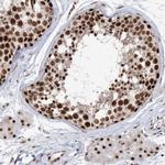 RBM17 Antibody in Immunohistochemistry (Paraffin) (IHC (P))