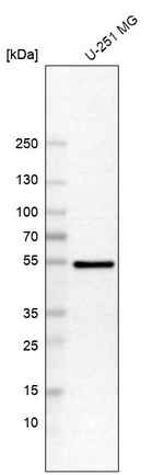 RBM17 Antibody in Western Blot (WB)