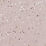 CCSER2 Antibody in Immunohistochemistry (Paraffin) (IHC (P))