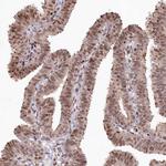 CCSER2 Antibody in Immunohistochemistry (Paraffin) (IHC (P))