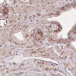 CCSER2 Polyclonal Antibody