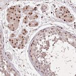 CCSER2 Antibody in Immunohistochemistry (Paraffin) (IHC (P))