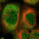 CCSER2 Polyclonal Antibody