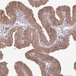 CCSER2 Antibody in Immunohistochemistry (Paraffin) (IHC (P))