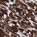 CCSER2 Antibody in Immunohistochemistry (Paraffin) (IHC (P))