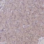 CCSER2 Antibody in Immunohistochemistry (Paraffin) (IHC (P))