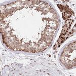 CCSER2 Antibody in Immunohistochemistry (Paraffin) (IHC (P))