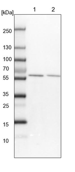 CCSER2 Antibody in Western Blot (WB)