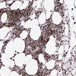 ZCCHC8 Antibody in Immunohistochemistry (Paraffin) (IHC (P))