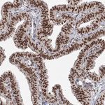 ZCCHC8 Polyclonal Antibody