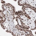 ZCCHC8 Antibody in Immunohistochemistry (Paraffin) (IHC (P))