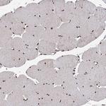 ZCCHC8 Antibody in Immunohistochemistry (Paraffin) (IHC (P))