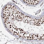 ZCCHC8 Antibody in Immunohistochemistry (Paraffin) (IHC (P))
