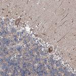 MPP9 Antibody in Immunohistochemistry (Paraffin) (IHC (P))