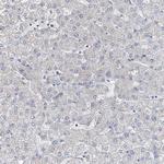 MPP9 Antibody in Immunohistochemistry (Paraffin) (IHC (P))