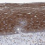 MPP9 Antibody in Immunohistochemistry (IHC)