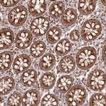 DNA2 Polyclonal Antibody