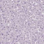DNAH12 Polyclonal Antibody