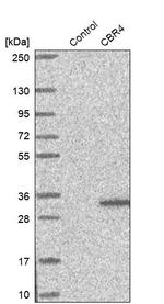 CBR4 Antibody in Western Blot (WB)