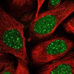 RAP80 Polyclonal Antibody