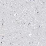 RAP80 Antibody in Immunohistochemistry (Paraffin) (IHC (P))