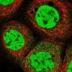 POLR2B Polyclonal Antibody