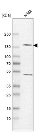 POLR2B Antibody in Western Blot (WB)