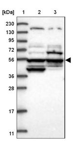 POC5 Antibody in Western Blot (WB)