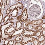 eRF1 Polyclonal Antibody