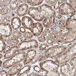 FAM120B Polyclonal Antibody