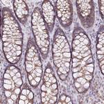 ZFYVE27 Antibody in Immunohistochemistry (Paraffin) (IHC (P))