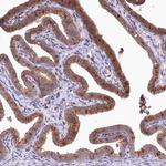 ZFYVE27 Antibody in Immunohistochemistry (Paraffin) (IHC (P))
