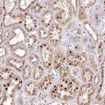 ZFYVE27 Antibody in Immunohistochemistry (Paraffin) (IHC (P))
