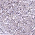 ZFYVE27 Antibody in Immunohistochemistry (Paraffin) (IHC (P))