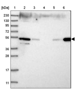 ZFYVE27 Antibody in Western Blot (WB)