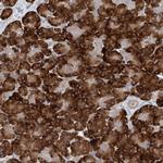 MMADHC Polyclonal Antibody