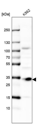 MMADHC Antibody in Western Blot (WB)
