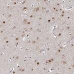 USP11 Polyclonal Antibody